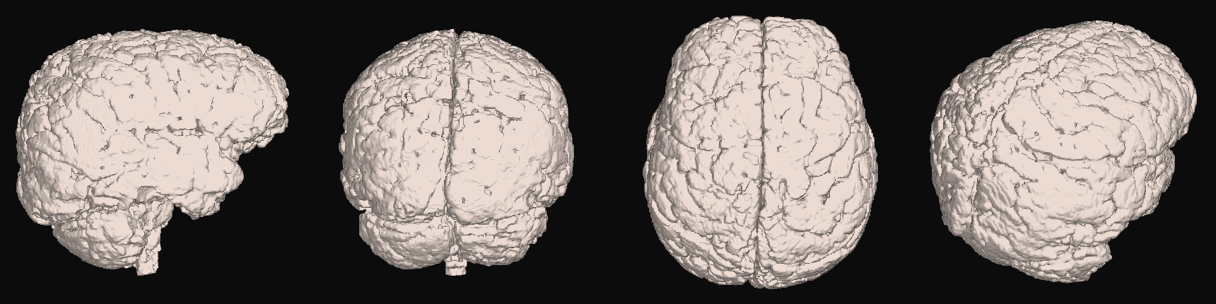 The cortical surface