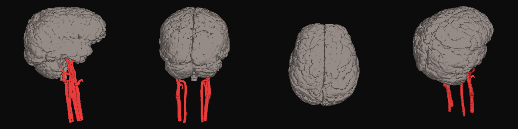 Arteries registered onto the brain
